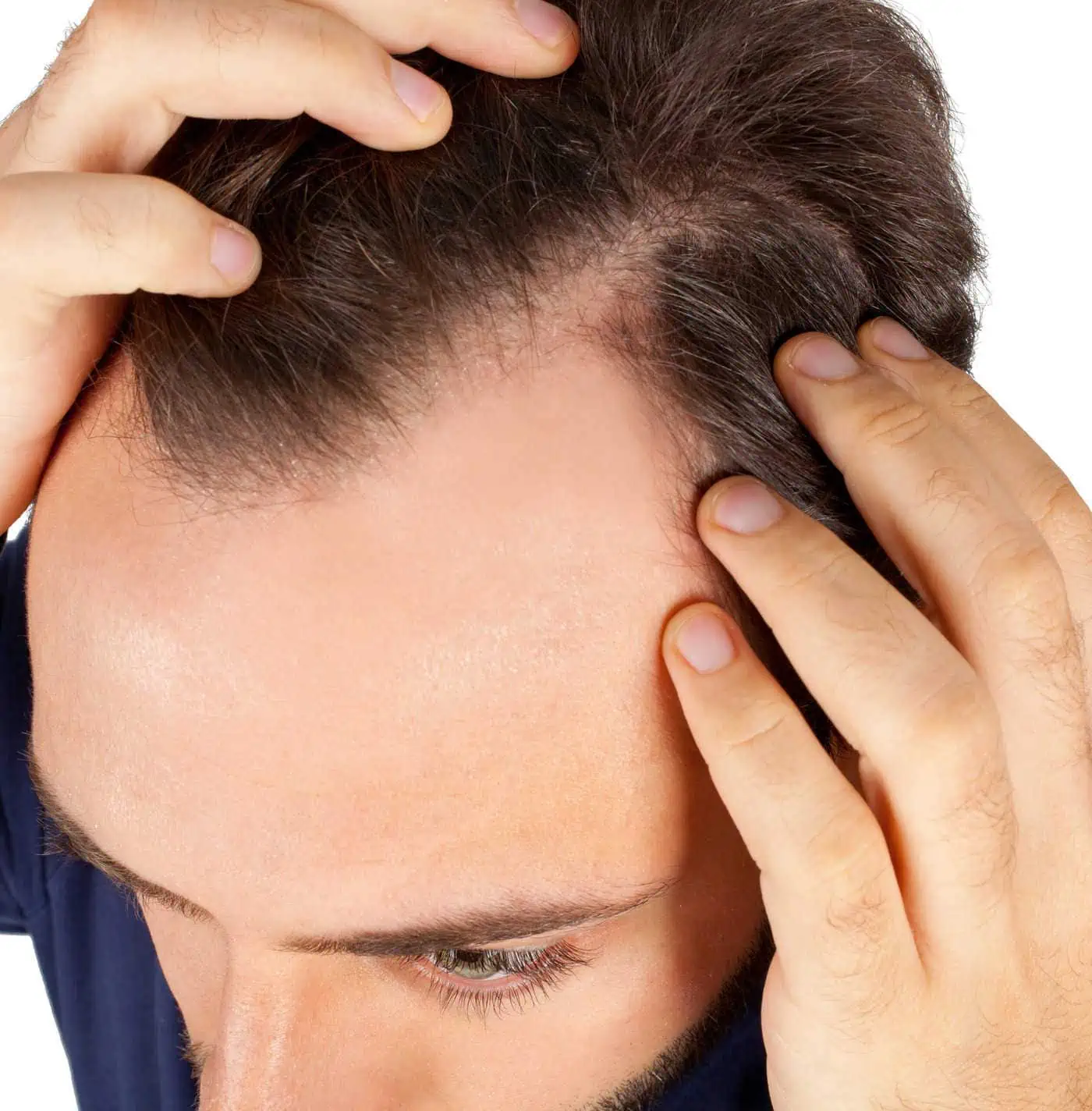 hair loss treatment in london